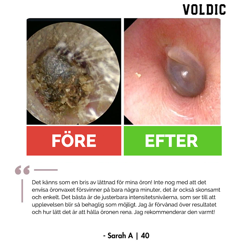 Voldic™ Elektrisk Öronvaxborttagningskit