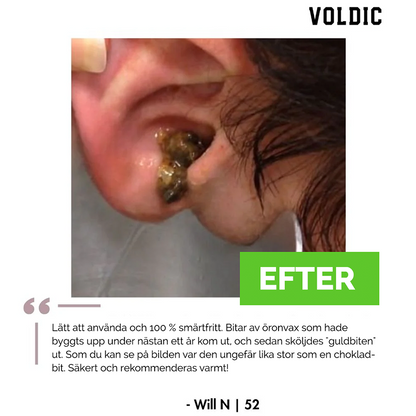 Voldic™ Elektrisk Öronvaxborttagningskit