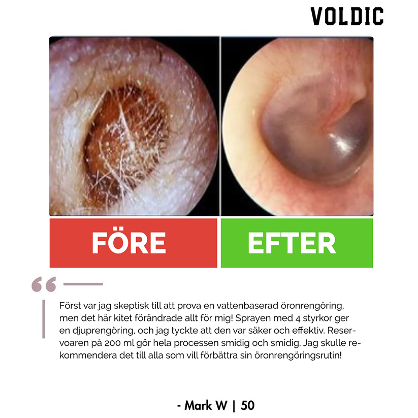 Voldic™ Elektrisk Öronvaxborttagningskit