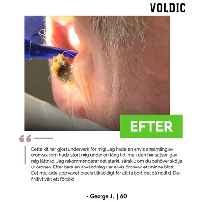 Voldic™ Elektrisk Öronvaxborttagningskit