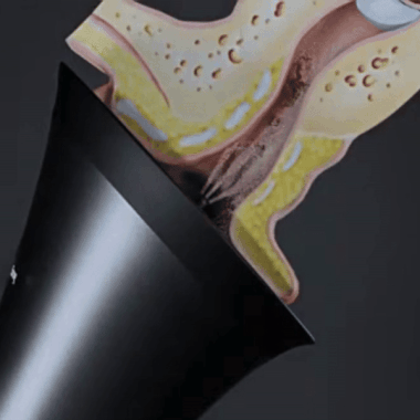 Voldic™ Elektrisk Öronvaxborttagningskit